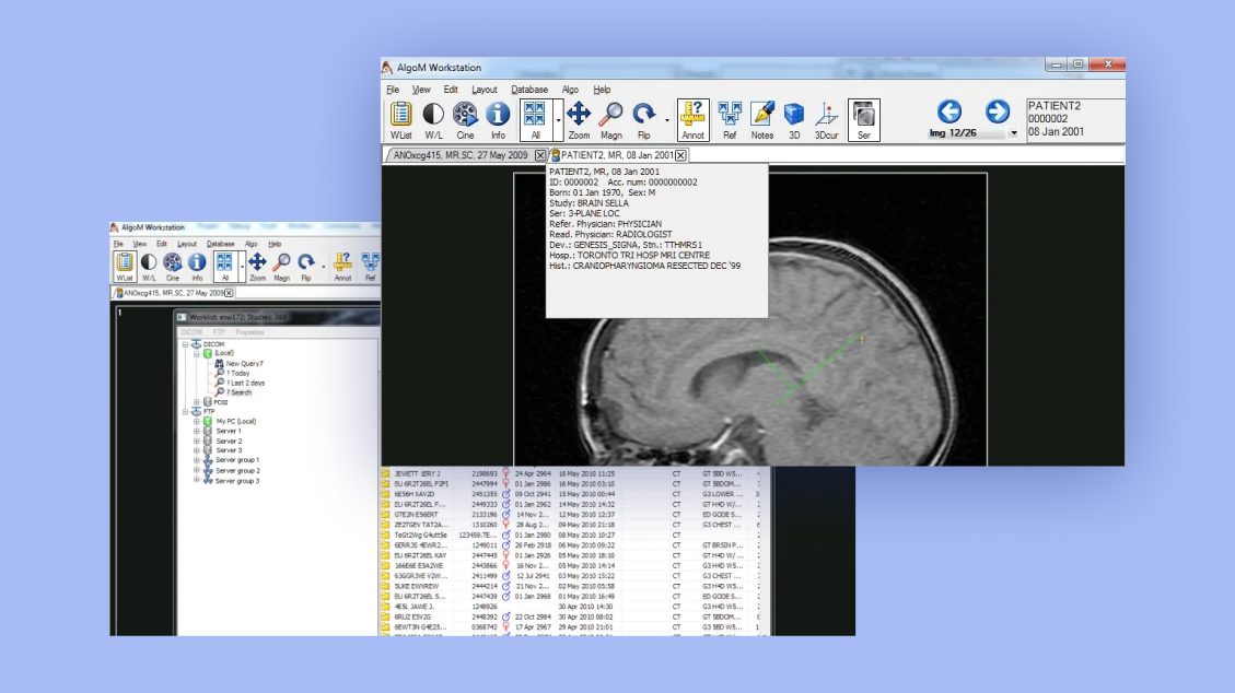  AlgoM DICOM* Viewer