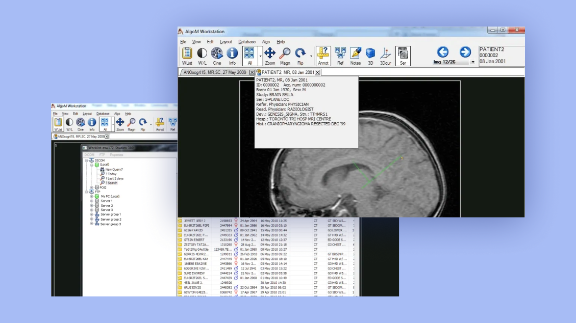 AlgoM DICOM Viewer application interface example