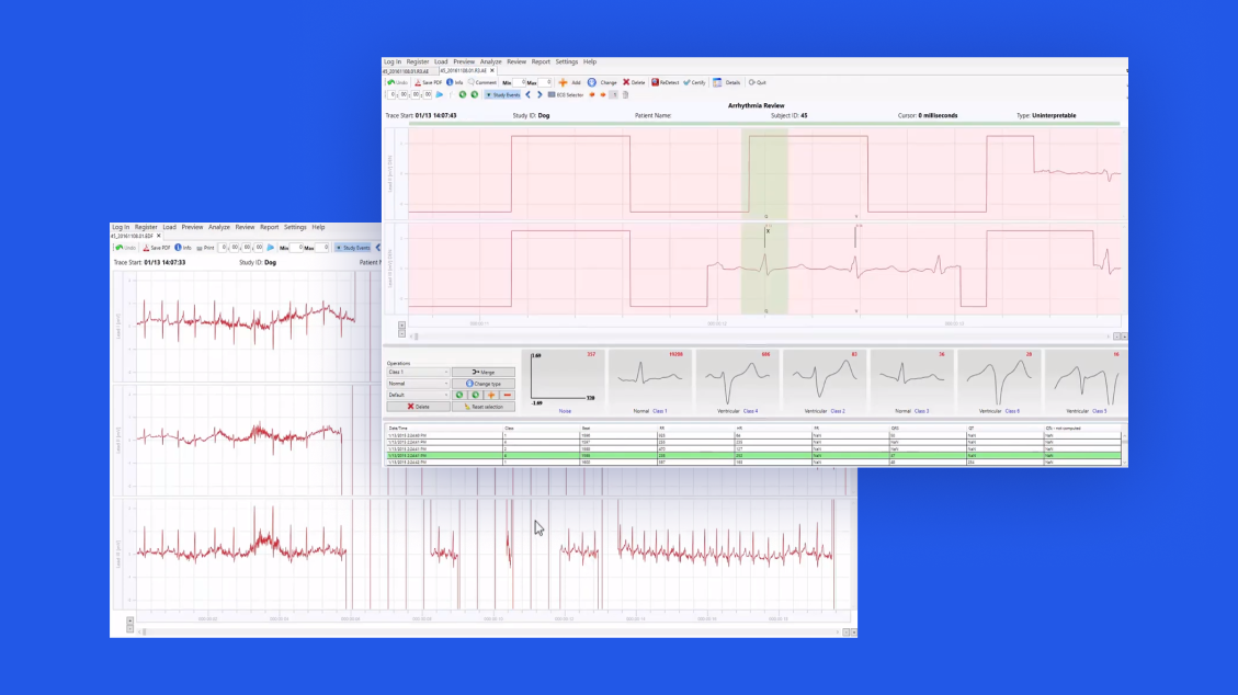 ECG analysis solution